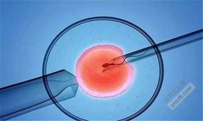 试管婴儿技术面面观 理解潜在风险与核心优势